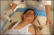 Женщину лечат мертвыми скорпионами в больнице Цзинана (Китай)