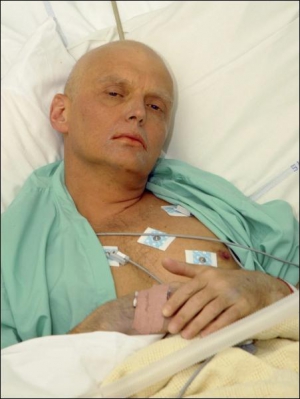 После отравления у бывшего российского агента Александра Литвиненко полностью выпали волосы. Сейчас мужчина лежит в лондонской больнице