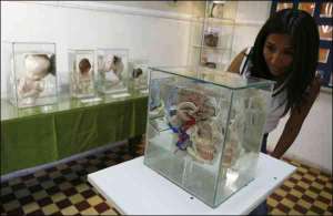 Посетительница рассматривает один из экспонатов в частном музее Дианы Ривас, который находится в столице Перу городе Лима. Человек, которому принадлежал мозг, умер от нервного расстройства