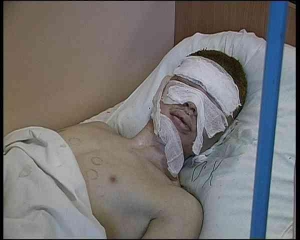 Полтавчанин Александр Петренко в городской больнице. Парень переживал, чтобы на его лице не осталось шрамов