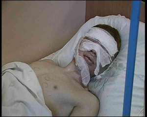 Полтавчанин Олександр Петренко у міській лікарні. Хлопець переживав, щоб на його обличчі не лишилося шрамів