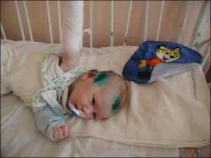 Тримісячний Олексій Шикула в Чернігівській дитячій обласній лікарні. Рани на голові дитини обробили зеленкою