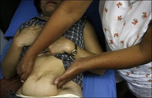 50-річна знахарка Мінда з передмістя філіппінської столиці Маніли показує техніку ”масажу”, за допомогою якого вона робить аборти