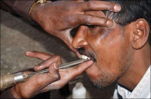 Уличный дантист одного из индийских городов выравнивает клиенту зубы