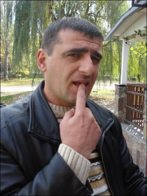 Гражданин Грузии Сосо Джанджгава показывает, какой зуб ему хотели вырвать плоскогубцами милиционеры Кировского горрайотдела на Донетчине