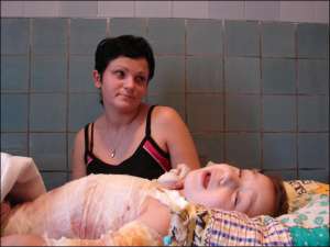 Назар Куценков в ожоговом центре областной больницы Хмельницкого. Мальчик постоянно плачет — болят раны на спине, груди, животе, руках. Рядом с ним — мать Теодора