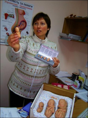 Директор Центру допомоги вагітним у Полтаві Олена Тимофієва показує муляжі зародків дітей, починаючи з 7 тижнів. Вони зроблені з силікону. У правій руці у неї 11-тижневий зародок. На такому терміні часто переривають вагітність