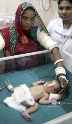 Новорожденная дочь Бхури Кальби в настоящее время находится в больнице, потому что появилась на свет преждевременно