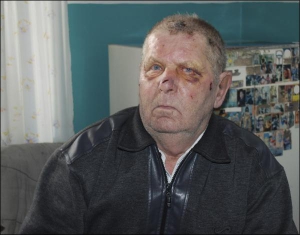 Дмитрий Бруско из города Кременчуг Полтавской области спал, когда в его дом ворвались двое ребят. Проснулся, когда услышал шорох на кухне