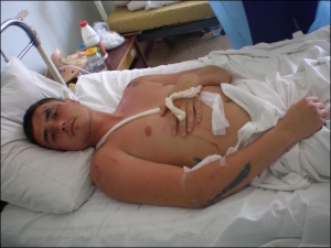Луганчанин Олександр Кар’ян лікується в травматології обласної лікарні. Чоловік відпочивав з дружиною на пляжі, як на нього наскочив позашляховик