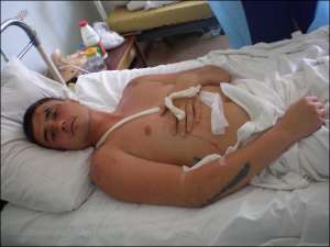 Луганчанин Александр Карьян лечится в травматологии областной больницы. Мужчина отдыхал с женой на пляже, когда на него наскочил внедорожник