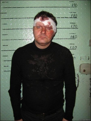 Леонида Нефедовича фотографируют возле измерительной шкалы в горотделе милиции Кременчуга после аварии. Разбившееся лобовое стекло повредило ему глаз