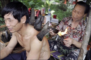 На улице города Наньнин в Китае мужчину лечат от боли. К спине ему прикладывают рог, спиленный до формы чаши. Китайские целители практикуют массаж рогами свыше двух тысяч лет
