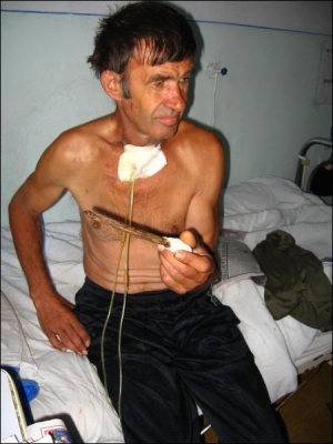 Анатолий Грисюк в Хмельницкой больнице держит ветку бузины, которая проткнула ему горло