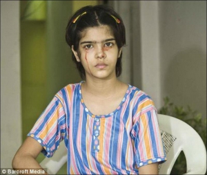 Через рідкісне захворювання індійка 13-річна Твінкі Двіведі інколи прокидається вкрита кров’янистою кіркою