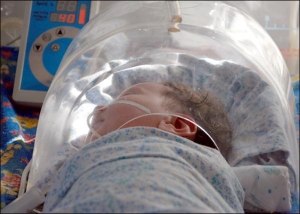 Девочка Ангелина лежит в реанимации инфекционной больницы Полтавы. Мать кормила младенца сырым молоком и печеньем