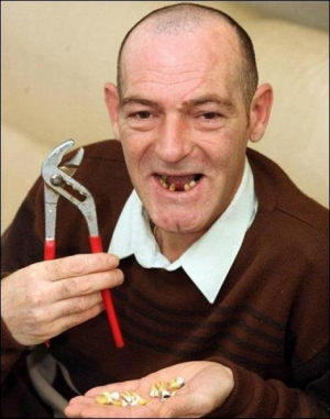 Британець Ієн Бойнтон тримає у долоні зуби, які власноруч вирвав з верхньої щелепи