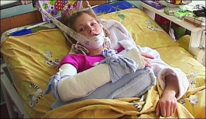 13-летняя Елизавета Глушкова находится в детской городской клинической больнице города Полтавы. У нее сломана правая ключица и подвывих шейных позвонков. Ближайшие дней десять она будет лежать неподвижно
