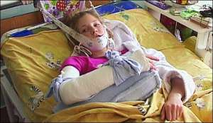 13-річна Єлизавета Глушкова перебуває в дитячій міській клінічній лікарні міста Полтави. У неї зламана права ключиця та підвивих шийних хребців. Найближчі днів десять вона лежатиме нерухомо 
