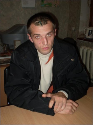 Житомирянину Олегу Кукурику у банку розбили голову. Він планує вимагати у фінансової установи відшкодування моральних і матеріальних збитків