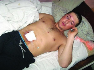 Сергій Шабанов лежить у лікарні швидкої допомоги у місті Маріуполі Донецької області. Куля пробила йому живіт