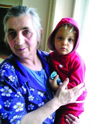 Тернополянка София Кузь держит на руках внучку Христину. У девочки остались шрамы на голове, правая рука длиннее левой
