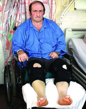 Мик Виллари лечит в госпитале города Ньюкасл переломы ног. Врачи заверяют, что с пациентом все будет в порядке — он будет ходить