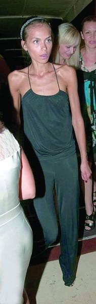 ”Мисс Киев-2007” Оксана Островска на вечеринке в одном из столичных клубов. Психоаналитика говорит, что такой вид могут иметь люди, больные анорексией