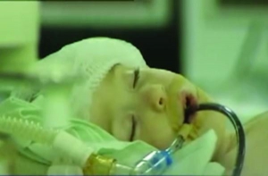 3-річна Вікторія Подунай чекала операції на серці півтора року. Німецький імплантат коштує 50 тисяч гривень