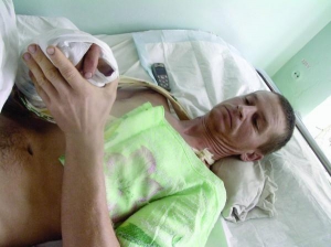 Віталій Власенко лежить у реанімаційному відділенні лікарні райцентру Тальне Черкаської області. Не відчуває правої руки