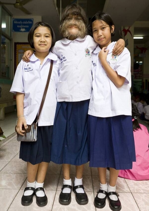 Таїландка Супатра Сасупфан (посередині) обіймає своїх однокласниць. Батьки боялися віддавати дівчинку до школи, щоб із неї не посміхалися