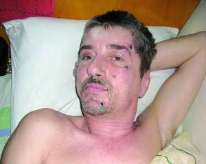 Хмельничанин Володимир Ксьондз лежить у лікарні. Він частково втратив пам’ять
