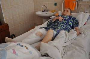 Надія Зозолюк лежить у ортопедо-травматологічному відділенні Рівненської обласної лікарні. Жінці зробили щеплення від сказу