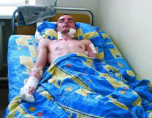 Таксист Віталій Куций лежить у вівторок, 12 липня, в лікарні міста Умань на Черкащині. Лікарі кажуть, він одужає через три тижні