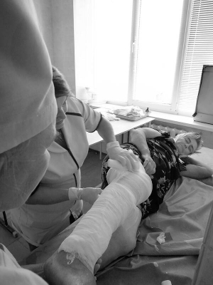 Лікарі травмопункту першої міської лікарні Полтави накладають гіпс 78-річній полтавці Лідії. Жінка впала у себе в хаті та забила коліно
