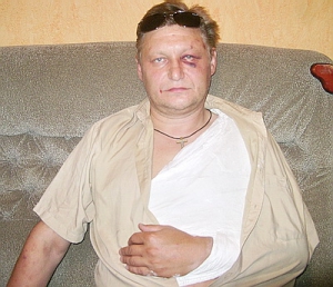 Андрей Саламатов после нападения болельщиков