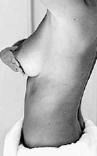Жінки з 20 років раз на місяць мають промацувати груди, чи не з’явилися затвердіння.  Після 30 років треба робити мамографію — рентген молочної залози