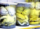 Муміфіковані двоголові немовлята — експонати відділу ”Тератологія” львівського Музею хвороб. Раніше діти з вродженими вадами розвитку народжувалися дуже часто — через генетичні мутації та кровозмішування