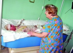 Ірина Надель лежить на ліжку, наповненому розпушеним силіконом. Такі використовують для опікових хворих, яким боляче торкатися до шкіри. Поряд сидить мати Ірини — Надія Миколаївна