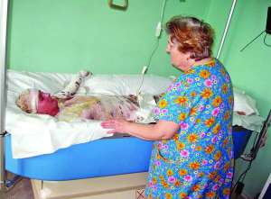 Ірина Надель лежить на ліжку, наповненому розпушеним силіконом. Такі використовують для опікових хворих, яким боляче торкатися до шкіри. Поряд сидить мати Ірини — Надія Миколаївна