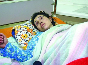 Вікторія Ніжинська лікує опіки у Великомихайлівській районній лікарні Одеської області. У пожежі 24 січня загинули четверо її дітей