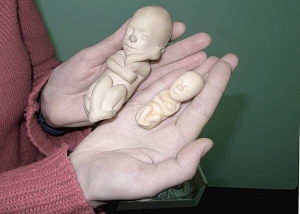 Лариса Малашецька з Полтавського центру допомоги вагітним показує моделі ембріонів. У правій руці 12-тижневий. Плід може мружитися, ковтати, розрізняє смаки, відчуває біль. Зріст — 7 сантиметрів. На такому терміні дозволені аборти. У лівій руці — 20-тижневий плід