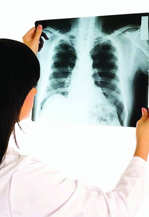 Предмети в легенях видно під час комп’ютерної томографії. Без обстеження людина роками кашлятиме, але лікарі не визначать причини