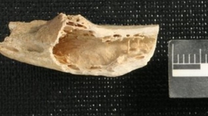 Скам'яніле ребро неандертальця зі слідами кісткової пухлини було знайдено в неглибокій печері Крапина в Хорватії