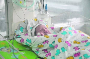 Новонароджену дівчинку лікують у Полтавській міській дитячій лікарні. Вона з'явилася на світ здоровою
