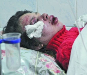 Побита журналістка ­Тетяна ­Чорновол у Борис­пільській лікарні в ніч на 25 грудня. Нападники проломили їй череп, ­зламали перего­родку носа та щелепу. Має численні забої м’яких тканин обличчя і грудей
