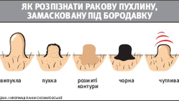 Папиллома при беременности к кому обращаться