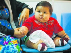 Восьмимісячного Сантьяго мати годувала щоразу, як плакав. Має вагу шестирічної дитини