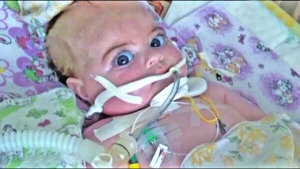8-місячний Євген Єзєкян зі Слов’янська підключений до апарата штучного дихання. Батьки хочуть вивезти сина на лікування до Росії