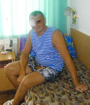Роман Бовсунівський  відпочиває у палаті після перев’язки. Він мешкає із  двома бійцями, які теж мали поранення на оці